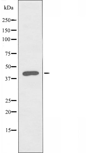 DF3913 staining HepG2 by IF/ICC. The sample were fixed with PFA and permeabilized in 0.1% Triton X-100,then blocked in 10% serum for 45 minutes at 25¡ãC. The primary antibody was diluted at 1/200 and incubated with the sample for 1 hour at 37¡ãC. An  Alexa Fluor 594 conjugated goat anti-rabbit IgG (H+L) Ab, diluted at 1/600, was used as the secondary antibod