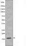 DF3914 staining  HT29 cells by IF/ICC. The sample were fixed with PFA and permeabilized in 0.1% Triton X-100,then blocked in 10% serum for 45 minutes at 25¡ãC. The primary antibody was diluted at 1/200 and incubated with the sample for 1 hour at 37¡ãC. An  Alexa Fluor 594 conjugated goat anti-rabbit IgG (H+L) antibody(Cat.