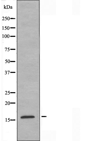 DF3914 staining  HT29 cells by IF/ICC. The sample were fixed with PFA and permeabilized in 0.1% Triton X-100,then blocked in 10% serum for 45 minutes at 25¡ãC. The primary antibody was diluted at 1/200 and incubated with the sample for 1 hour at 37¡ãC. An  Alexa Fluor 594 conjugated goat anti-rabbit IgG (H+L) antibody(Cat.