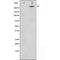 DF3915 staining  Hela cells by IF/ICC. The sample were fixed with PFA and permeabilized in 0.1% Triton X-100,then blocked in 10% serum for 45 minutes at 25¡ãC. The primary antibody was diluted at 1/200 and incubated with the sample for 1 hour at 37¡ãC. An  Alexa Fluor 594 conjugated goat anti-rabbit IgG (H+L) antibody(Cat.
