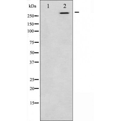DF3915 staining  Hela cells by IF/ICC. The sample were fixed with PFA and permeabilized in 0.1% Triton X-100,then blocked in 10% serum for 45 minutes at 25¡ãC. The primary antibody was diluted at 1/200 and incubated with the sample for 1 hour at 37¡ãC. An  Alexa Fluor 594 conjugated goat anti-rabbit IgG (H+L) antibody(Cat.
