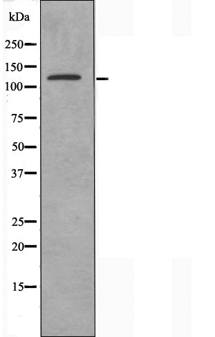 DF3916 staining COLO205 cells by IF/ICC. The sample were fixed with PFA and permeabilized in 0.1% Triton X-100,then blocked in 10% serum for 45 minutes at 25¡ãC. The primary antibody was diluted at 1/200 and incubated with the sample for 1 hour at 37¡ãC. An  Alexa Fluor 594 conjugated goat anti-rabbit IgG (H+L) antibody(Cat.