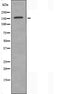 DF3917 at 1/100 staining Human prostate tissue by IHC-P. The sample was formaldehyde fixed and a heat mediated antigen retrieval step in citrate buffer was performed. The sample was then blocked and incubated with the antibody for 1.5 hours at 22¡ãC. An HRP conjugated goat anti-rabbit antibody was used as the secondary