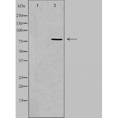 DF3922 at 1/100 staining Mouse testis tissue by IHC-P. The sample was formaldehyde fixed and a heat mediated antigen retrieval step in citrate buffer was performed. The sample was then blocked and incubated with the antibody for 1.5 hours at 22¡ãC. An HRP conjugated goat anti-rabbit antibody was used as the secondary