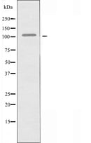 DF3963 at 1/100 staining Human uterus tissue by IHC-P. The sample was formaldehyde fixed and a heat mediated antigen retrieval step in citrate buffer was performed. The sample was then blocked and incubated with the antibody for 1.5 hours at 22¡ãC. An HRP conjugated goat anti-rabbit antibody was used as the secondary