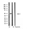 DF4033 at 1/100 staining Human uterus tissue by IHC-P. The sample was formaldehyde fixed and a heat mediated antigen retrieval step in citrate buffer was performed. The sample was then blocked and incubated with the antibody for 1.5 hours at 22¡ãC. An HRP conjugated goat anti-rabbit antibody was used as the secondary