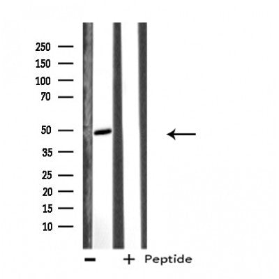 DF4033 at 1/100 staining Human uterus tissue by IHC-P. The sample was formaldehyde fixed and a heat mediated antigen retrieval step in citrate buffer was performed. The sample was then blocked and incubated with the antibody for 1.5 hours at 22¡ãC. An HRP conjugated goat anti-rabbit antibody was used as the secondary