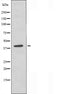 DF3973 staining HepG2 by IF/ICC. The sample were fixed with PFA and permeabilized in 0.1% Triton X-100,then blocked in 10% serum for 45 minutes at 25¡ãC. The primary antibody was diluted at 1/200 and incubated with the sample for 1 hour at 37¡ãC. An  Alexa Fluor 594 conjugated goat anti-rabbit IgG (H+L) Ab, diluted at 1/600, was used as the secondary antibod