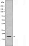 DF3975 staining A549 by IF/ICC. The sample were fixed with PFA and permeabilized in 0.1% Triton X-100,then blocked in 10% serum for 45 minutes at 25¡ãC. The primary antibody was diluted at 1/200 and incubated with the sample for 1 hour at 37¡ãC. An  Alexa Fluor 594 conjugated goat anti-rabbit IgG (H+L) Ab, diluted at 1/600, was used as the secondary antibod