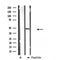 DF3991 at 1/100 staining Mouse lung tissue by IHC-P. The sample was formaldehyde fixed and a heat mediated antigen retrieval step in citrate buffer was performed. The sample was then blocked and incubated with the antibody for 1.5 hours at 22¡ãC. An HRP conjugated goat anti-rabbit antibody was used as the secondary