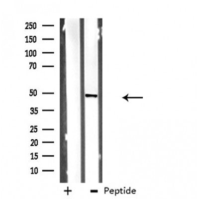 DF3991 at 1/100 staining Mouse lung tissue by IHC-P. The sample was formaldehyde fixed and a heat mediated antigen retrieval step in citrate buffer was performed. The sample was then blocked and incubated with the antibody for 1.5 hours at 22¡ãC. An HRP conjugated goat anti-rabbit antibody was used as the secondary