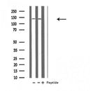 DF4001 at 1/100 staining Mouse brain tissue by IHC-P. The sample was formaldehyde fixed and a heat mediated antigen retrieval step in citrate buffer was performed. The sample was then blocked and incubated with the antibody for 1.5 hours at 22¡ãC. An HRP conjugated goat anti-rabbit antibody was used as the secondary