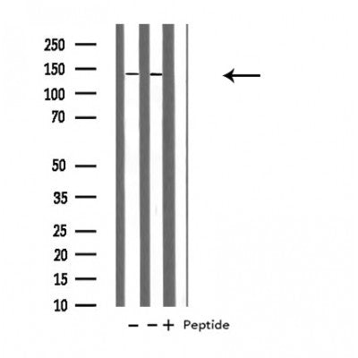 DF4001 at 1/100 staining Mouse brain tissue by IHC-P. The sample was formaldehyde fixed and a heat mediated antigen retrieval step in citrate buffer was performed. The sample was then blocked and incubated with the antibody for 1.5 hours at 22¡ãC. An HRP conjugated goat anti-rabbit antibody was used as the secondary