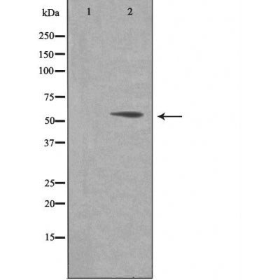 DF4002 staining  A549 cells by IF/ICC. The sample were fixed with PFA and permeabilized in 0.1% Triton X-100,then blocked in 10% serum for 45 minutes at 25¡ãC. The primary antibody was diluted at 1/200 and incubated with the sample for 1 hour at 37¡ãC. An  Alexa Fluor 594 conjugated goat anti-rabbit IgG (H+L) antibody(Cat.