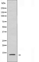 DF4003 staining HepG2 by IF/ICC. The sample were fixed with PFA and permeabilized in 0.1% Triton X-100,then blocked in 10% serum for 45 minutes at 25¡ãC. The primary antibody was diluted at 1/200 and incubated with the sample for 1 hour at 37¡ãC. An  Alexa Fluor 594 conjugated goat anti-rabbit IgG (H+L) Ab, diluted at 1/600, was used as the secondary antibod