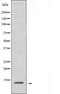 DF4003 staining HepG2 by IF/ICC. The sample were fixed with PFA and permeabilized in 0.1% Triton X-100,then blocked in 10% serum for 45 minutes at 25¡ãC. The primary antibody was diluted at 1/200 and incubated with the sample for 1 hour at 37¡ãC. An  Alexa Fluor 594 conjugated goat anti-rabbit IgG (H+L) Ab, diluted at 1/600, was used as the secondary antibod
