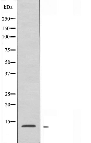 DF4003 staining HepG2 by IF/ICC. The sample were fixed with PFA and permeabilized in 0.1% Triton X-100,then blocked in 10% serum for 45 minutes at 25¡ãC. The primary antibody was diluted at 1/200 and incubated with the sample for 1 hour at 37¡ãC. An  Alexa Fluor 594 conjugated goat anti-rabbit IgG (H+L) Ab, diluted at 1/600, was used as the secondary antibod