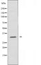 DF4011 staining Hela by IF/ICC. The sample were fixed with PFA and permeabilized in 0.1% Triton X-100,then blocked in 10% serum for 45 minutes at 25¡ãC. The primary antibody was diluted at 1/200 and incubated with the sample for 1 hour at 37¡ãC. An  Alexa Fluor 594 conjugated goat anti-rabbit IgG (H+L) Ab, diluted at 1/600, was used as the secondary antibod