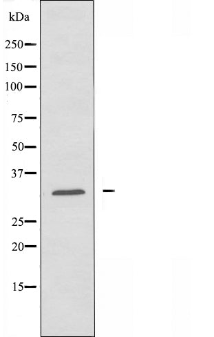 DF4011 staining Hela by IF/ICC. The sample were fixed with PFA and permeabilized in 0.1% Triton X-100,then blocked in 10% serum for 45 minutes at 25¡ãC. The primary antibody was diluted at 1/200 and incubated with the sample for 1 hour at 37¡ãC. An  Alexa Fluor 594 conjugated goat anti-rabbit IgG (H+L) Ab, diluted at 1/600, was used as the secondary antibod