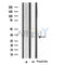 DF4028 staining HeLa cells by IF/ICC. The sample were fixed with PFA and permeabilized in 0.1% Triton X-100,then blocked in 10% serum for 45 minutes at 25¡ãC. The primary antibody was diluted at 1/200 and incubated with the sample for 1 hour at 37¡ãC. An  Alexa Fluor 594 conjugated goat anti-rabbit IgG (H+L) antibody(Cat.