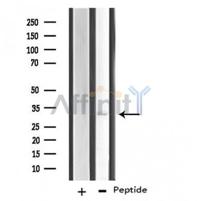 DF4028 staining HeLa cells by IF/ICC. The sample were fixed with PFA and permeabilized in 0.1% Triton X-100,then blocked in 10% serum for 45 minutes at 25¡ãC. The primary antibody was diluted at 1/200 and incubated with the sample for 1 hour at 37¡ãC. An  Alexa Fluor 594 conjugated goat anti-rabbit IgG (H+L) antibody(Cat.