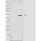 DF4112 staining Hela by IF/ICC. The sample were fixed with PFA and permeabilized in 0.1% Triton X-100,then blocked in 10% serum for 45 minutes at 25¡ãC. The primary antibody was diluted at 1/200 and incubated with the sample for 1 hour at 37¡ãC. An  Alexa Fluor 594 conjugated goat anti-rabbit IgG (H+L) Ab, diluted at 1/600, was used as the secondary antibod