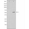 DF4072 staining LOVO by IF/ICC. The sample were fixed with PFA and permeabilized in 0.1% Triton X-100,then blocked in 10% serum for 45 minutes at 25¡ãC. The primary antibody was diluted at 1/200 and incubated with the sample for 1 hour at 37¡ãC. An  Alexa Fluor 594 conjugated goat anti-rabbit IgG (H+L) Ab, diluted at 1/600, was used as the secondary antibod