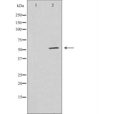 DF4072 staining LOVO by IF/ICC. The sample were fixed with PFA and permeabilized in 0.1% Triton X-100,then blocked in 10% serum for 45 minutes at 25¡ãC. The primary antibody was diluted at 1/200 and incubated with the sample for 1 hour at 37¡ãC. An  Alexa Fluor 594 conjugated goat anti-rabbit IgG (H+L) Ab, diluted at 1/600, was used as the secondary antibod