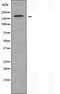 DF4086 staining Hela by IF/ICC. The sample were fixed with PFA and permeabilized in 0.1% Triton X-100,then blocked in 10% serum for 45 minutes at 25¡ãC. The primary antibody was diluted at 1/200 and incubated with the sample for 1 hour at 37¡ãC. An  Alexa Fluor 594 conjugated goat anti-rabbit IgG (H+L) Ab, diluted at 1/600, was used as the secondary antibod