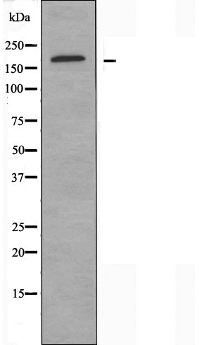DF4086 staining Hela by IF/ICC. The sample were fixed with PFA and permeabilized in 0.1% Triton X-100,then blocked in 10% serum for 45 minutes at 25¡ãC. The primary antibody was diluted at 1/200 and incubated with the sample for 1 hour at 37¡ãC. An  Alexa Fluor 594 conjugated goat anti-rabbit IgG (H+L) Ab, diluted at 1/600, was used as the secondary antibod
