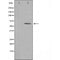 DF4091 staining HuvEc cells by IF/ICC. The sample were fixed with PFA and permeabilized in 0.1% Triton X-100,then blocked in 10% serum for 45 minutes at 25¡ãC. The primary antibody was diluted at 1/200 and incubated with the sample for 1 hour at 37¡ãC. An  Alexa Fluor 594 conjugated goat anti-rabbit IgG (H+L) antibody(Cat.