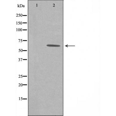 DF4091 staining HuvEc cells by IF/ICC. The sample were fixed with PFA and permeabilized in 0.1% Triton X-100,then blocked in 10% serum for 45 minutes at 25¡ãC. The primary antibody was diluted at 1/200 and incubated with the sample for 1 hour at 37¡ãC. An  Alexa Fluor 594 conjugated goat anti-rabbit IgG (H+L) antibody(Cat.