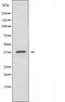 DF4100 staining HT29 by IF/ICC. The sample were fixed with PFA and permeabilized in 0.1% Triton X-100,then blocked in 10% serum for 45 minutes at 25¡ãC. The primary antibody was diluted at 1/200 and incubated with the sample for 1 hour at 37¡ãC. An  Alexa Fluor 594 conjugated goat anti-rabbit IgG (H+L) Ab, diluted at 1/600, was used as the secondary antibod