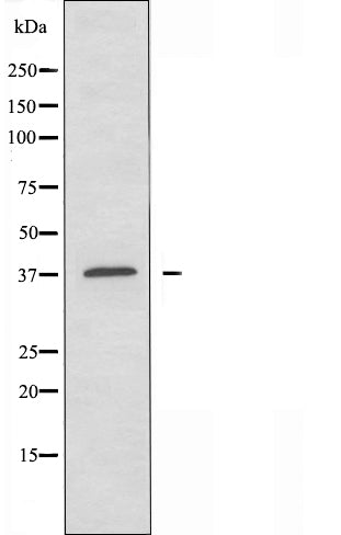 DF4100 staining HT29 by IF/ICC. The sample were fixed with PFA and permeabilized in 0.1% Triton X-100,then blocked in 10% serum for 45 minutes at 25¡ãC. The primary antibody was diluted at 1/200 and incubated with the sample for 1 hour at 37¡ãC. An  Alexa Fluor 594 conjugated goat anti-rabbit IgG (H+L) Ab, diluted at 1/600, was used as the secondary antibod