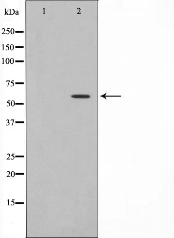 Western blot analysis on A549 cell lysate using Phospho-HBP1(Ser402) Antibody.The lane on the left is treated with the antigen-specific peptide.