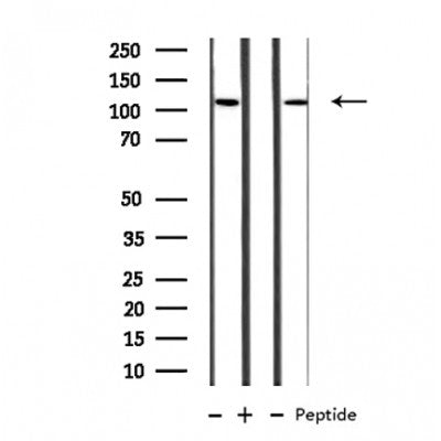 Western blot analysis of extracts from Hela, using MBTPS1 Antibody. Lane 1 was treated with the antigen-specific peptide.