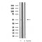 DF4235 staining HT29 by IF/ICC. The sample were fixed with PFA and permeabilized in 0.1% Triton X-100,then blocked in 10% serum for 45 minutes at 25¡ãC. The primary antibody was diluted at 1/200 and incubated with the sample for 1 hour at 37¡ãC. An  Alexa Fluor 594 conjugated goat anti-rabbit IgG (H+L) Ab, diluted at 1/600, was used as the secondary antibod