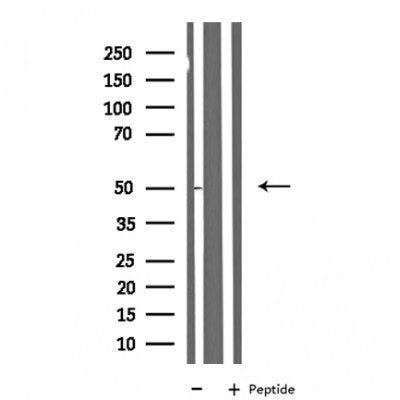 DF4235 staining HT29 by IF/ICC. The sample were fixed with PFA and permeabilized in 0.1% Triton X-100,then blocked in 10% serum for 45 minutes at 25¡ãC. The primary antibody was diluted at 1/200 and incubated with the sample for 1 hour at 37¡ãC. An  Alexa Fluor 594 conjugated goat anti-rabbit IgG (H+L) Ab, diluted at 1/600, was used as the secondary antibod