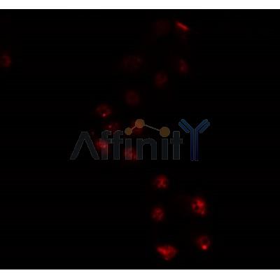 AF0338 staining A549 by IF/ICC. The sample were fixed with PFA and permeabilized in 0.1% Triton X-100,then blocked in 10% serum for 45 minutes at 25¡ãC. The primary antibody was diluted at 1/200 and incubated with the sample for 1 hour at 37¡ãC. An  Alexa Fluor 594 conjugated goat anti-rabbit IgG (H+L) Ab, diluted at 1/600, was used as the secondary antibod