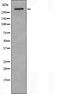 DF4285 staining HepG2 by IF/ICC. The sample were fixed with PFA and permeabilized in 0.1% Triton X-100,then blocked in 10% serum for 45 minutes at 25¡ãC. The primary antibody was diluted at 1/200 and incubated with the sample for 1 hour at 37¡ãC. An  Alexa Fluor 594 conjugated goat anti-rabbit IgG (H+L) Ab, diluted at 1/600, was used as the secondary antibod