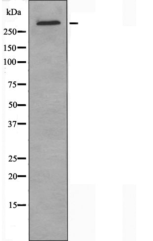 DF4285 staining HepG2 by IF/ICC. The sample were fixed with PFA and permeabilized in 0.1% Triton X-100,then blocked in 10% serum for 45 minutes at 25¡ãC. The primary antibody was diluted at 1/200 and incubated with the sample for 1 hour at 37¡ãC. An  Alexa Fluor 594 conjugated goat anti-rabbit IgG (H+L) Ab, diluted at 1/600, was used as the secondary antibod
