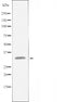 DF4474 staining HepG2 by IF/ICC. The sample were fixed with PFA and permeabilized in 0.1% Triton X-100,then blocked in 10% serum for 45 minutes at 25¡ãC. The primary antibody was diluted at 1/200 and incubated with the sample for 1 hour at 37¡ãC. An  Alexa Fluor 594 conjugated goat anti-rabbit IgG (H+L) Ab, diluted at 1/600, was used as the secondary antibod