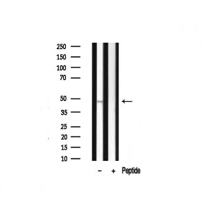 Western blot analysis on mouse brain lysate using DLX3 Antibody