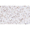 AF0339 at 1/100 staining human muscle tissue sections by IHC-P. The tissue was formaldehyde fixed and a heat mediated antigen retrieval step in citrate buffer was performed. The tissue was then blocked and incubated with the antibody for 1.5 hours at 22¡ãC. An HRP conjugated goat anti-rabbit antibody was used as the secondary