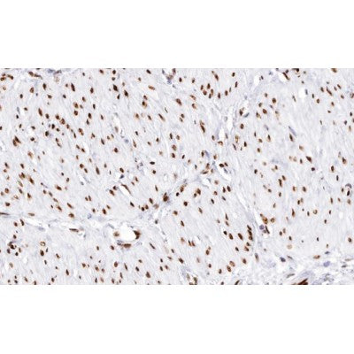 AF0339 at 1/100 staining human muscle tissue sections by IHC-P. The tissue was formaldehyde fixed and a heat mediated antigen retrieval step in citrate buffer was performed. The tissue was then blocked and incubated with the antibody for 1.5 hours at 22¡ãC. An HRP conjugated goat anti-rabbit antibody was used as the secondary