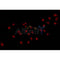 AF0339 staining 293 by IF/ICC. The sample were fixed with PFA and permeabilized in 0.1% Triton X-100,then blocked in 10% serum for 45 minutes at 25¡ãC. The primary antibody was diluted at 1/200 and incubated with the sample for 1 hour at 37¡ãC. An  Alexa Fluor 594 conjugated goat anti-rabbit IgG (H+L) Ab, diluted at 1/600, was used as the secondary antibod