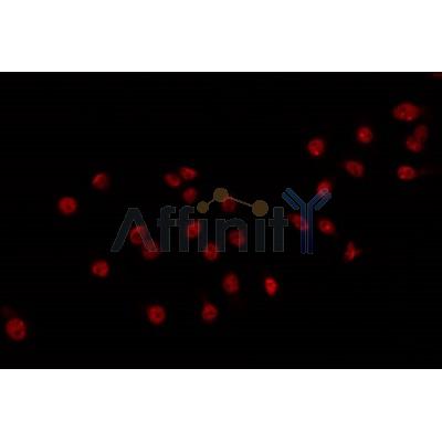 AF0339 staining 293 by IF/ICC. The sample were fixed with PFA and permeabilized in 0.1% Triton X-100,then blocked in 10% serum for 45 minutes at 25¡ãC. The primary antibody was diluted at 1/200 and incubated with the sample for 1 hour at 37¡ãC. An  Alexa Fluor 594 conjugated goat anti-rabbit IgG (H+L) Ab, diluted at 1/600, was used as the secondary antibod