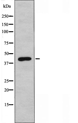 DF4394 staining  HepG2 cells by IF/ICC. The sample were fixed with PFA and permeabilized in 0.1% Triton X-100,then blocked in 10% serum for 45 minutes at 25¡ãC. The primary antibody was diluted at 1/200 and incubated with the sample for 1 hour at 37¡ãC. An  Alexa Fluor 594 conjugated goat anti-rabbit IgG (H+L) antibody(Cat.# S0006), diluted at 1/600, was used as secondary antibod