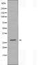 DF4395 staining MCF7 cells by IF/ICC. The sample were fixed with PFA and permeabilized in 0.1% Triton X-100,then blocked in 10% serum for 45 minutes at 25¡ãC. The primary antibody was diluted at 1/200 and incubated with the sample for 1 hour at 37¡ãC. An  Alexa Fluor 594 conjugated goat anti-rabbit IgG (H+L) antibody(Cat.# S0006), diluted at 1/600, was used as secondary antibod