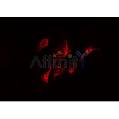 DF4396 staining Hela by IF/ICC. The sample were fixed with PFA and permeabilized in 0.1% Triton X-100,then blocked in 10% serum for 45 minutes at 25¡ãC. The primary antibody was diluted at 1/200 and incubated with the sample for 1 hour at 37¡ãC. An  Alexa Fluor 594 conjugated goat anti-rabbit IgG (H+L) Ab, diluted at 1/600, was used as the secondary antibod